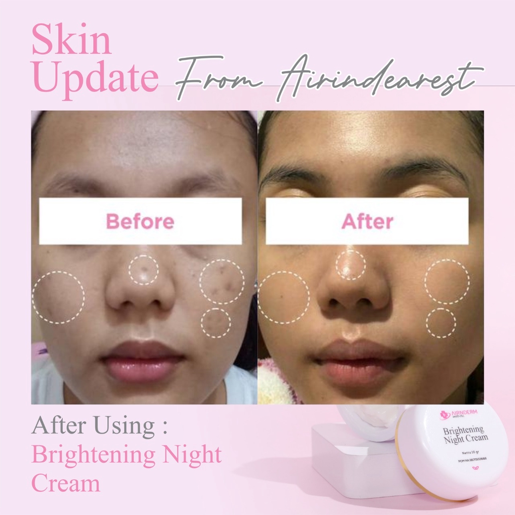 BRIGHTENING NIGHT CREAM - Gambar 3