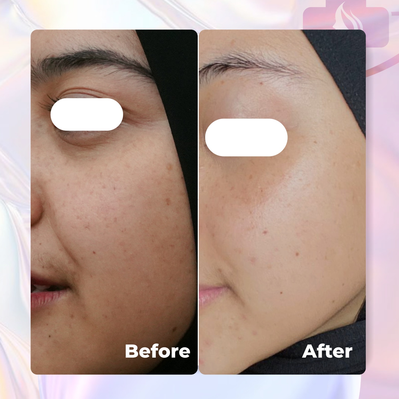 Airnderm Aesthetic Cysteamine Cream (by AIRIN BEAUTY) - Gambar 3